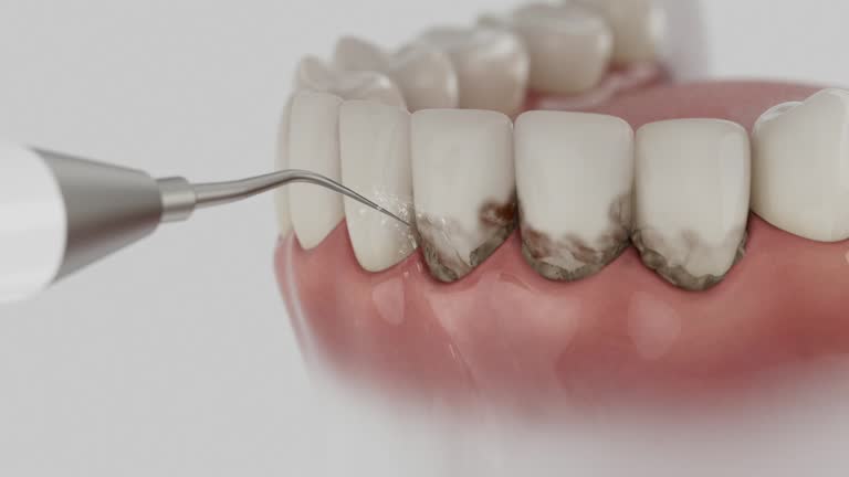 Reliable Teeth Cleaning And Checkup contractor in Copiah County County, MS by Dentist Open Now